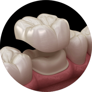 Tooth crown close up